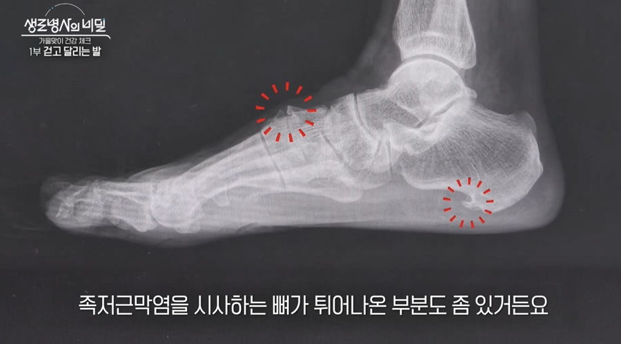 발은 아픈데, 원인은 발에만 있을까