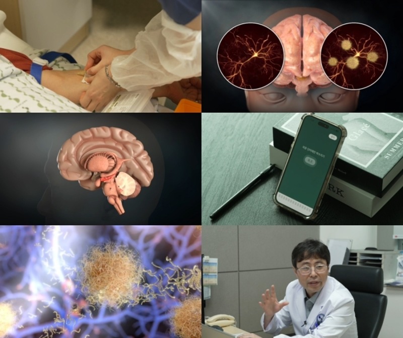 명의 990회 기억을 지키는 시간, 치매를 늦춰라